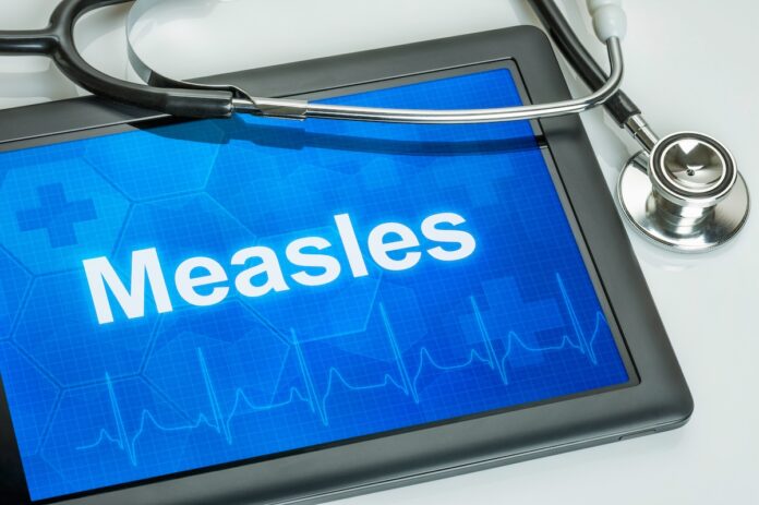 measles
